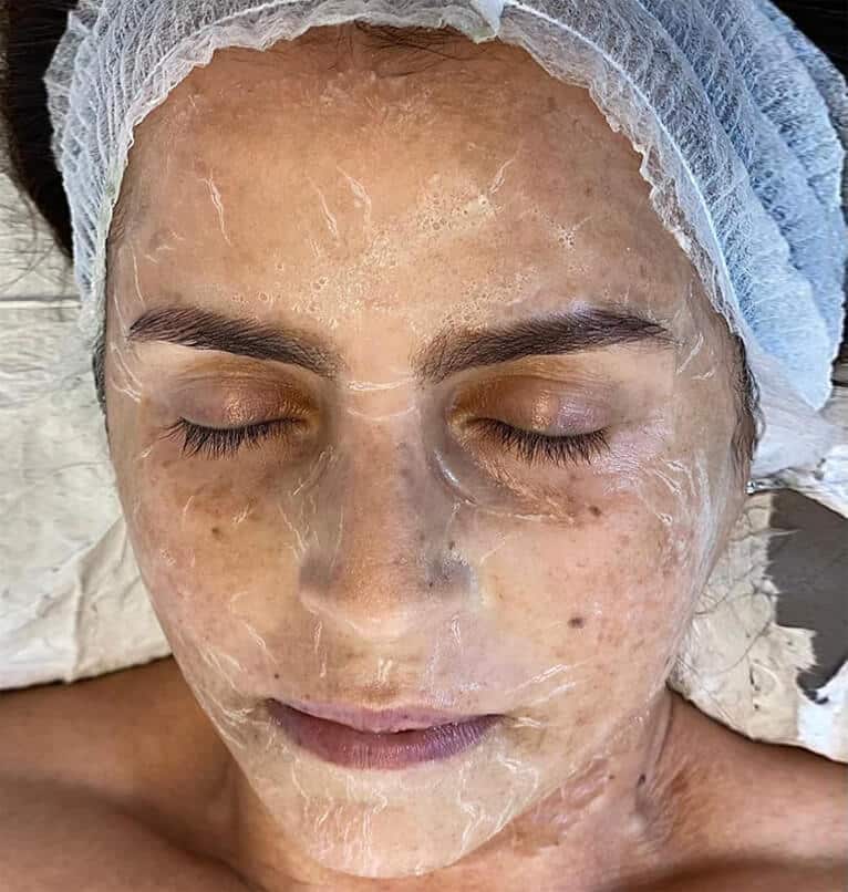Client receiving DMK Enzyme Therapy treatment, designed to oxygenate and detoxify the skin