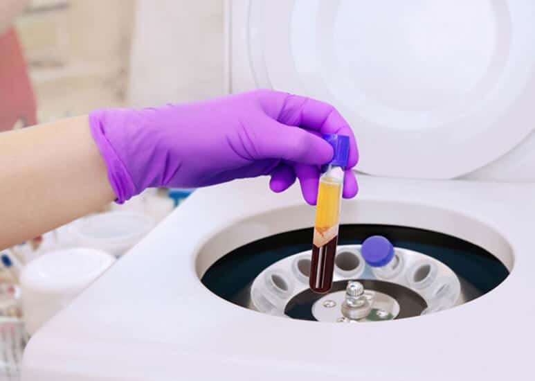 Preparing PRP treatment for neck and décolleté using a centrifuge to separate plasma.
